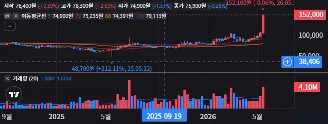 LG 주봉 차트