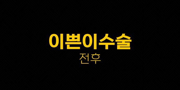 이쁜이수술 전후