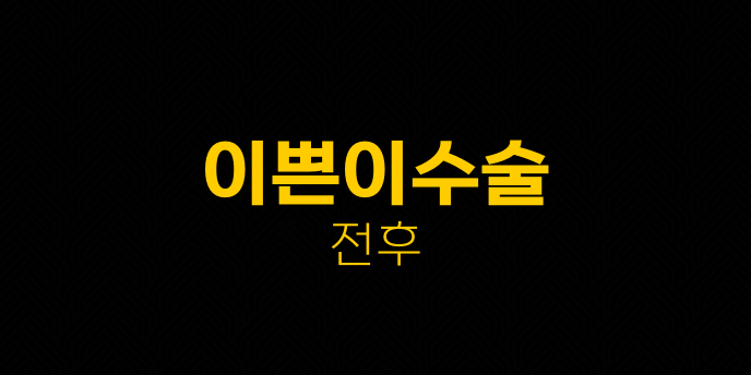 이쁜이수술 전후
